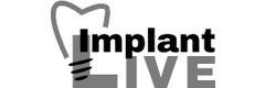 ImplantLive