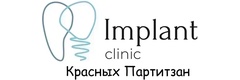 Имплант Клиник